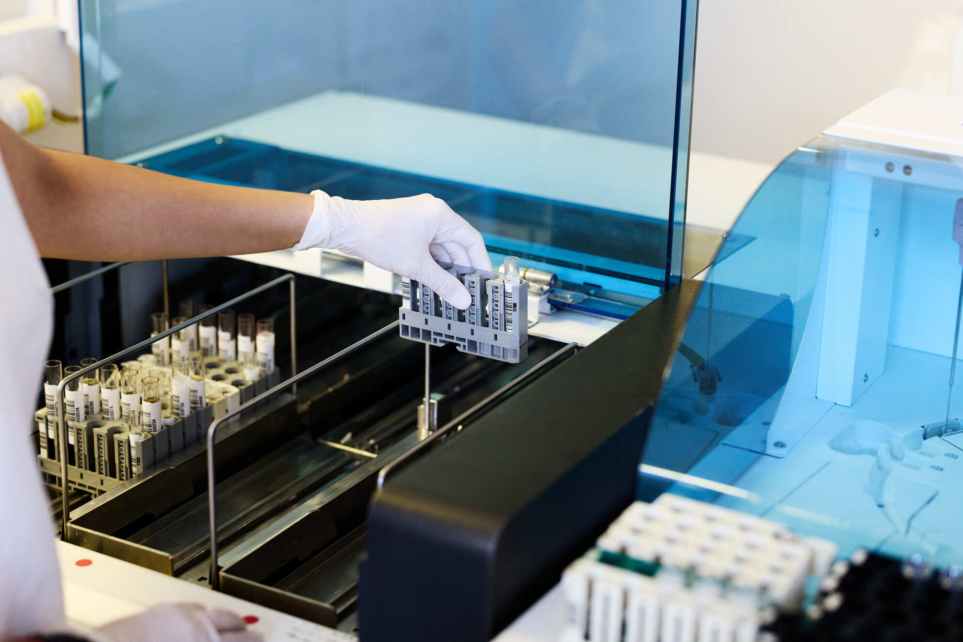 Procesamiento automatizado de muestras de laboratorio en el IADT