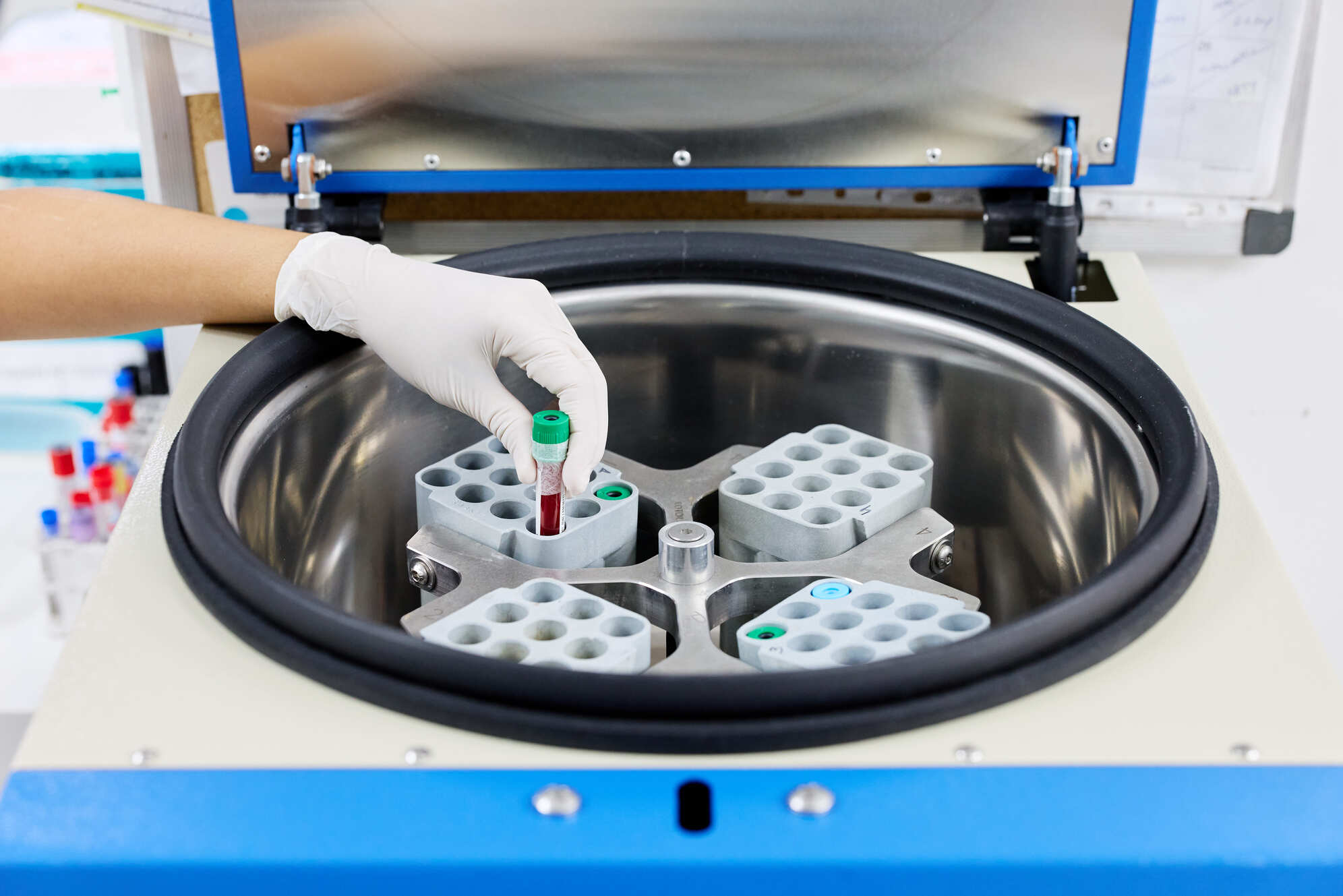 Preparación y centrifugación de muestras de sangre para análisis clínicos