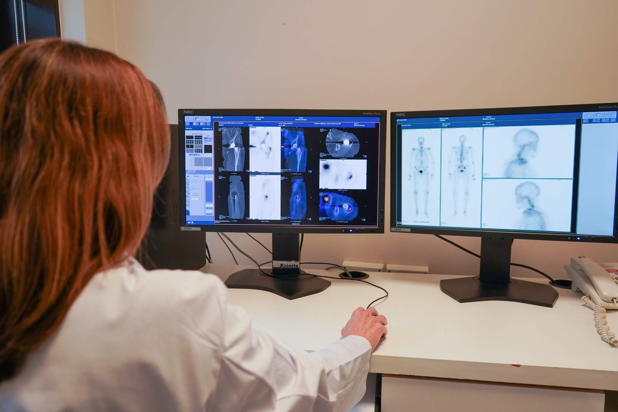 Médico especialista analizando imágenes obtenidas mediante estudios SPECT/CT en estación de trabajo avanzada.